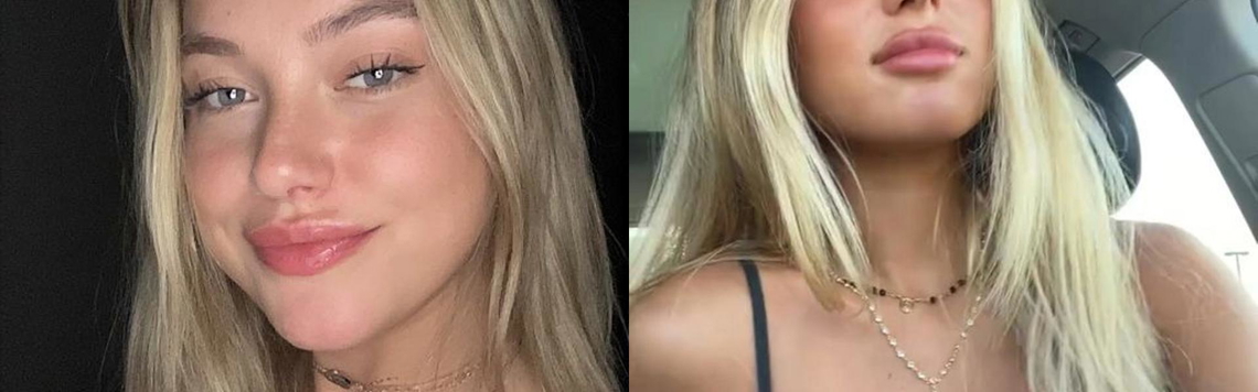 Profil Üst Görseli