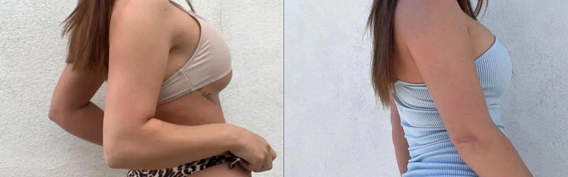 Profiilin otsikkokuva