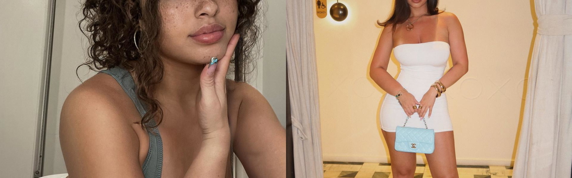 Ảnh tiêu đề hồ sơ